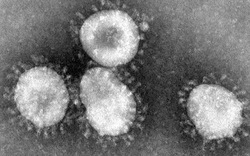Mỹ: Các nhân viên phòng thí nghiệm suýt làm lây lan virus chết người