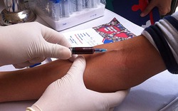 6% dân số Việt Nam nhiễm bệnh viêm gan C