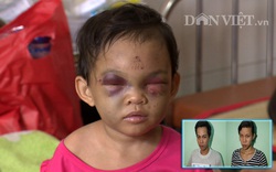 Bé 3 tuổi bị bố mẹ đánh chấn thương sọ não: Mẹ thương con mẹ đừng đánh con!