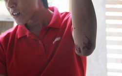 Kẻ tấn công, hành hung 4 phóng viên là giang hồ có tiếng ở Quảng Ngãi