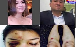 Đại gia Campuchia hành hung nữ diễn viên giữa chốn đông người