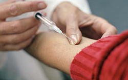 Khẩn trương tiêm vaccine bạch hầu
