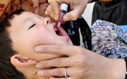 Trẻ nhiễm virus bại liệt có thể tử vong