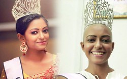 Hoa hậu gốc Ấn thành thần tượng giới trẻ vì cạo trọc
