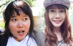 Màn thay đổi đáng kinh ngạc của thiếu nữ Thái mặt mụn