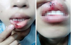 Công an Đồng Nai làm việc với nạn nhân vụ "clip bị đánh dập môi"