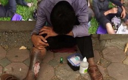 Kẻ giả vờ hoại tử chân xin tiền ở Hà Nội bị đánh bầm dập