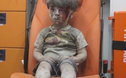 Dậy sóng vì bức ảnh em bé Syria người đầy máu