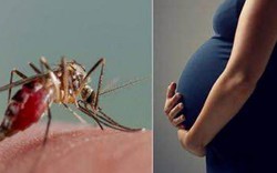 Thêm bệnh nhân mắc Zika sau khi trở về từ Việt Nam