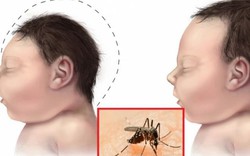 Liên tục phát hiện người nước ngoài nhiễm virus Zika nghi mắc ở Việt Nam