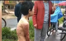 Đau lòng bé trai 12 tuổi bị bố lột trần, trói dây xích bắt diễu phố