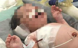Em bé sống sót kỳ diệu sau khi trúng đạn từ trong bụng mẹ