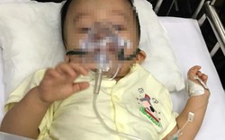 Thông tin bất ngờ vụ bé 1 tuổi bị bạo hành đến chấn thương sọ não