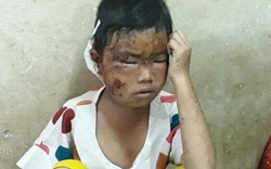 Lũ quét ở Sơn La: Trẻ mồ côi khóc thảm vì mất đi em ruột