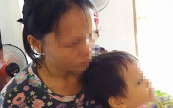 Vụ bé gái 1 tuổi bị xâm hại: Bị can 81 tuổi được tại ngoại