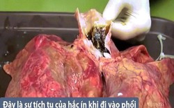 Phổi của bạn trông như thế nào sau khi hút 20 điếu thuốc lá?