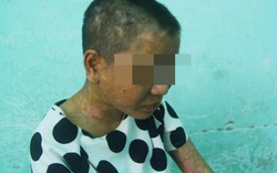 Vụ người phụ nữ bị tra tấn ở Gia Lai: Lời kể kinh hoàng như địa ngục