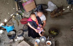 Điện Biên: Xót xa cảnh mẹ "bệnh H" nuôi con bị tan huyết bẩm sinh