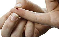 Dấu hiệu nhận biết một người bị nhiễm virus HIV