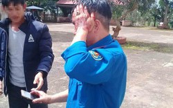 Lâm Đồng: 2 người nhận khoán rừng bị đánh trọng thương