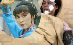 "Nữ hoàng kungfu" bị bỏng nặng vì hỏa hoạn trên trường quay