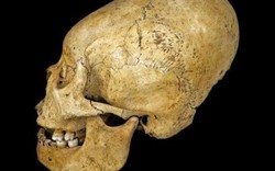 Vì sao người xưa đua nhau làm biến dạng hộp sọ?