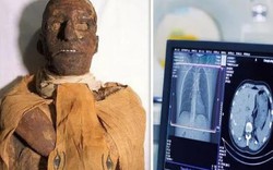 Chụp cắt lớp xác ướp pharaoh Ai Cập 3.000 tuổi, phát hiện bí mật choáng váng