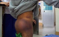 Bàn giao 4 học sinh bị người thân bạo hành ở Cà Mau cho cha mẹ