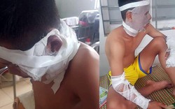 Nổ chùm bóng bay trong buổi khai mạc, 3 cầu thủ Sông Lam Nghệ An bị bỏng nặng