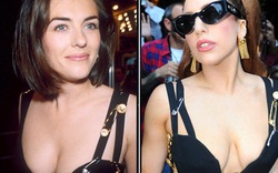 Diện váy &#34;nhái&#34; Liz Hurley, Lady Gaga lộ ngực chảy xệ