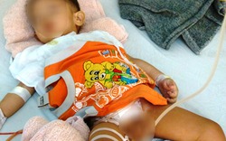 Vụ cắt nhầm bàng quang bé 21 tháng: Sở Y tế báo cáo UBND tỉnh