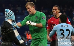 Rio Ferdinand bị CĐV Man City ném rách mắt