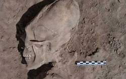 Tìm thấy hộp sọ biến dạng 1.000 năm tuổi