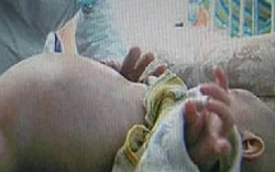 Kỳ lạ bé trai 2 tuổi mang thai… em ruột