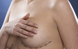 Chuyên gia phẫu thuật nhận định về ca hút mỡ, nâng ngực của phòng khám Cát Tường