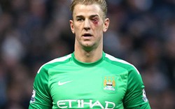 Cận cảnh chấn thương kinh hoàng của thủ thành Joe Hart