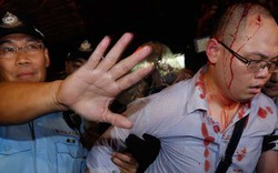 Cảnh sát Hong Kong xác nhận người biểu tình bị xã hội đen đánh