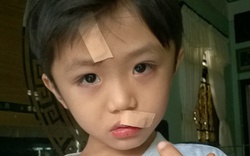 Cà Mau: Chai Fanta bất ngờ phát nổ, bé 6 tuổi phải khâu nhiều mũi