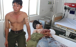 3 nhân viên bảo vệ rừng bị đánh đến nhập viện