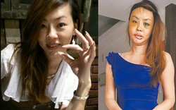 Nữ ca sĩ Đài Loan méo mặt vì “gọt sửa” quá đà