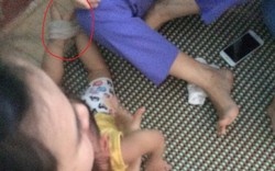 Phụ huynh tố cáo bảo mẫu trói tay chân hành hạ bé 15 tháng tuổi