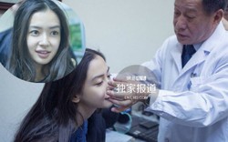 Angelababy "vịt hóa thiên nga" chỉ nhờ niềng răng