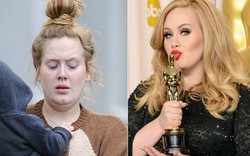 Adele trải lòng về ca phẫu thuật suýt khiến sự nghiệp chấm dứt