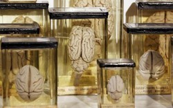 Mỹ: Đột nhập bảo tàng đánh cắp não người bán trên mạng