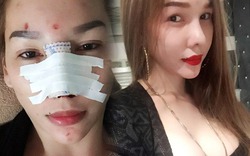 Mẫu chuyển giới Việt “xinh như mộng” sau khi sửa mũi