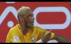 Clip Neymar chấn thương, máu me đầm đìa