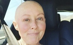 Fan xót xa sao nữ bị hủy hoại nhan sắc vì mắc ung thư
