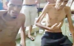 Phạm nhân bị bỏ đói trong nhà tù ở Venezuela