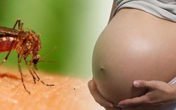 Một trẻ 4 tháng tuổi Việt Nam bị bệnh đầu nhỏ nghi do virus Zika