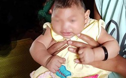 Mẹ của bé gái nghi mắc chứng đầu nhỏ ở Đắk Lắk từng nhiễm Zika